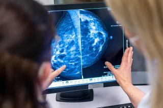 Plus de 250 femmes en Valais découvrent tous les ans qu'elles souffrent d'un cancer du sein